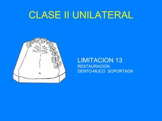 CLASE II UNILATERAL   LIMITACION 13 RESTAURACION  DENTO-MUCO  SOPORTADA 