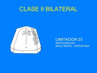 CLASE II BILATERAL LIMITACION 23 RESTAURACION  MUCO DENTO - SOPORTADA 