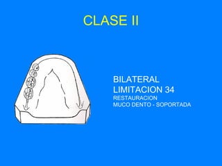CLASE II BILATERAL LIMITACION 34 RESTAURACION  MUCO DENTO - SOPORTADA 