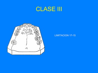 CLASE III LIMITACION 17-15 