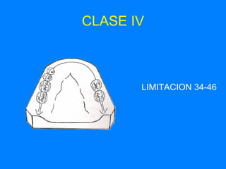 CLASE IV LIMITACION 34-46 