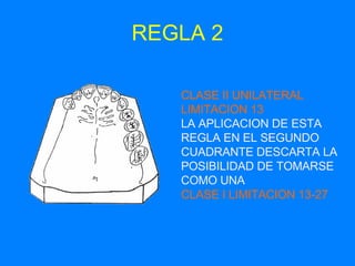 REGLA 2 CLASE II UNILATERAL LIMITACION 13 LA APLICACION DE ESTA REGLA EN EL SEGUNDO CUADRANTE DESCARTA LA POSIBILIDAD DE TOMARSE COMO UNA CLASE I LIMITACION 13-27 