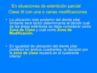 En situaciones de edentición parcial  Clase III con una o varias modificaciones   La ubicación más posterior del diente pilar limitante será factor determinante al decidir cuál de las áreas edéntulas se debe considerar como  Zona de Clase  y cual como  Zona de Modificación . En igualdad de ubicación del diente pilar posterior en ambos cuadrantes, la decisión por la  zona de clase  recaerá en el cuadrante inferior   