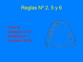 Reglas Nº 2, 5 y 6 Clase III Limitación 47-31 Modificación 1 Limitación 36-34 