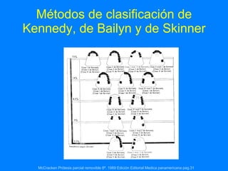 Métodos de clasificación de Kennedy, de Bailyn y de Skinner McCracken Prótesis parcial removible 8ª. 1989 Edición Editorial Medica panamericana pag.31   