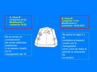 B. Clase III Limitación 17-16 Modificación 2 Limitación  16-23;2327 A. Clase III Limitación 27-23 Modificación 1 Limitación 16-23 No se toman en consideración las zonas edéntulas posteriores ni el espacio creado por la mesogresión del 16 Se aplica la regla 2 y se considera el espacio  creado por la mesogresión como zona de clase al permitir la colocación de  un póntico 