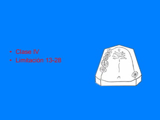 Clase IV Limitación 13-28 