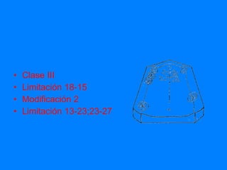 Clase III Limitación 18-15 Modificación 2 Limitación 13-23;23-27 