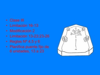 Clase III Limitación 16-13 Modificación 2 Limitación 13-23;23-26 Reglas Nº 4,5 y 6 Planifica puente fijo de 6 unidades, 13 a 23 