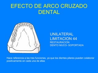EFECTO DE ARCO CRUZADO DENTAL UNILATERAL LIMITACION 44 RESTAURACION  DENTO MUCO- SOPORTADA Hace referencia a las tres funciones, ya que los dientes pilares pueden colaborar positivamente en cada una de ellas 
