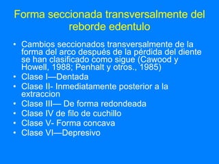 Forma seccionada transversalmente del reborde edentulo Cambios seccionados transversalmente de la forma del arco después de la pérdida del diente se han clasificado como sigue (Cawood y Howell, 1988; Penhalt y otros., 1985) Clase I—Dentada Clase II- Inmediatamente posterior a la extraccion Clase III— De forma redondeada  Clase IV de filo de cuchillo  Clase V- Forma concava Clase VI—Depresivo 