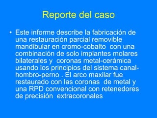 Reporte del caso Este informe describe la fabricación de una restauración parcial removible mandibular en cromo-cobalto  con una combinación de solo implantes molares bilaterales y  coronas metal-cerámica usando los principios del sistema canal-hombro-perno . El arco maxilar fue restaurado con las coronas  de metal y una RPD convencional con retenedores de precisión  extracoronales 