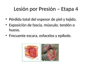 ClasificacionNPIAP LESIONES POR PRESION.pptx