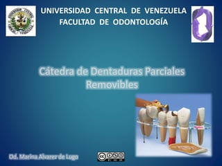 Cátedra de Dentaduras Parciales
Removibles
UNIVERSIDAD CENTRAL DE VENEZUELA
FACULTAD DE ODONTOLOGÍA
Od. Marina Alvarez de Lugo
 