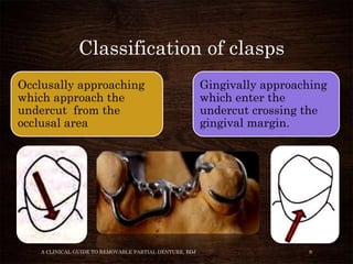 Clasp Designs - Dr. devi | PPTX