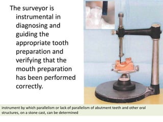 The surveyor is
instrumental in
diagnosing and
guiding the
appropriate tooth
preparation and
verifying that the
mouth preparation
has been performed
correctly.
instrument by which parallelism or lack of parallelism of abutment teeth and other oral
structures, on a stone cast, can be determined
 