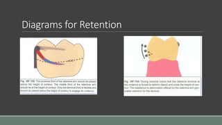 Diagrams for Retention
 