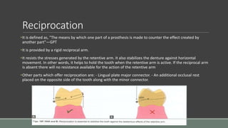 Reciprocation
•It is defined as, "The means by which one part of a prosthesis is made to counter the effect created by
another part"—GPT
•It is provided by a rigid reciprocal arm.
•It resists the stresses generated by the retentive arm. It also stabilizes the denture against horizontal
movement. In other words, it helps to hold the tooth when the retentive arm is active. If the reciprocal arm
is absent there will no resistance available for the action of the retentive arm
•Other parts which offer reciprocation are: - Lingual plate major connector. - An additional occlusal rest
placed on the opposite side of the tooth along with the minor connector.
 