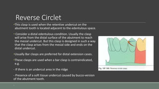 Reverse Circlet
•This clasp is used when the retentive undercut on the
abutment tooth is located adjacent to the edentulous space.
• Consider a distal edentulous condition. Usually the clasp
will arise from the distal surface of the abutment to reach
the mesial undercut. But this clasp is designed in such a way
that the clasp arises from the mesial side and ends on the
distal undercut.
•Usually Bar clasps are preferred for distal extension cases.
•These clasps are used when a bar clasp is contraindicated,
e.g.
- If there is an undercut area in the ridge
- Presence of a soft tissue undercut caused by bucco-version
of the abutment tooth.
.
 