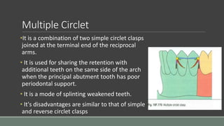 Multiple Circlet
•It is a combination of two simple circlet clasps
joined at the terminal end of the reciprocal
arms.
• It is used for sharing the retention with
additional teeth on the same side of the arch
when the principal abutment tooth has poor
periodontal support.
• It is a mode of splinting weakened teeth.
• It's disadvantages are similar to that of simple
and reverse circlet clasps
 