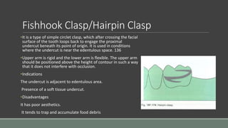 Fishhook Clasp/Hairpin Clasp
•It is a type of simple circlet clasp, which after crossing the facial
surface of the tooth loops back to engage the proximal
undercut beneath its point of origin. It is used in conditions
where the undercut is near the edentulous space. 136
•Upper arm is rigid and the lower arm is flexible. The upper arm
should be positioned above the height of contour in such a way
that it does not interfere with occlusion.
•Indications
The undercut is adjacent to edentulous area.
Presence of a soft tissue undercut.
•Disadvantages
It has poor aesthetics.
It tends to trap and accumulate food debris
 