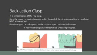 Back action Clasp
• It is a modification of the ring clasp.
•Here the minor connector is connected to the end of the clasp arm and the occlusal rest
is left unsupported.
•Disadvantages- Lack of support to the occlusal aspect reduces its function.
- It has both biological and mechanical unsound principles.
 
