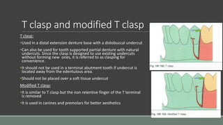 T clasp and modified T clasp
T clasp:
•Used in a distal extension denture base with a distobuccal undercut
•Can also be used for tooth supported partial denture with natural
undercuts. Since the clasp is designed to use existing undercuts
without forming new ones, it is referred to as clasping for
convenience.
•It should not be used in a terminal abutment tooth if undercut is
located away from the edentulous area.
•Should not be placed over a soft tissue undercut
Modified T clasp:
•It is similar to T clasp but the non retentive finger of the T terminal
is removed
•It is used in canines and premolars for better aesthetics
 