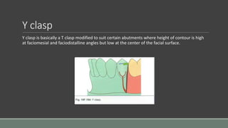 Y clasp
Y clasp is basically a T clasp modified to suit certain abutments where height of contour is high
at faciomesial and faciodistalline angles but low at the center of the facial surface.
 