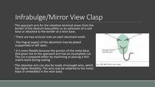 Infrabulge/Mirror View Clasp
•The approach arm for the retentive terminal arises from the
border of the denture base,either as an extension of a cast
base or attached to the border of a resin base.
• There are two occlusal rests on each abutment tooth.
• The lingual aspect of the abutment may be plated
(supported) or left open.
• It is more flexible because the portion of the metal base
that gives rise to the approach arm has an incomplete cut.
The cut is prepared either by machining or placing a thin
matrix band during casting
•The retentive arm can also be made of wrought wire, which
has higher flexibility. The wire may be soldered to the metal
base or embedded in the resin base.
 