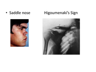 Congenital Syphillis, Reccurent Apthae, Behcets and Reiter's Syndrome.. |  PPT