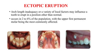 clinical problem related to eruption and shedding | PPTX