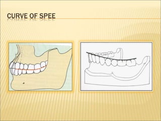 CURVE OF SPEE
 