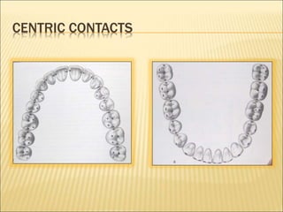 CENTRIC CONTACTS
 