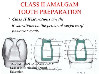 CLASS II AMALGAM
TOOTH PREPARATION
• Class II Restorations are the
Restorations on the proximal surfaces of
posterior teeth.
INDIAN DENTAL ACADEMY
Leader in continuing Dental
Education
www.indiandentalacademy.com
 