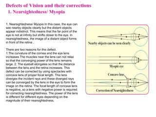 1. Nearsightedness/ Myopia In this case, the eye can
see nearby objects clearly but the distant objects
appear indistinct. This means that the far point of the
eye is not at infinity but shifts closer to the eye. In
nearsightedness, the image of a distant object forms
in front of the retina .
There are two reasons for this defect.
1.The curvature of the cornea and the eye lens
increases.The muscles near the lens can not relax
so that the converging power of the lens remains
large. 2. The eyeball elongates so that the distance
between the lens and the retina increases. This
defect can be corrected by using spectacles with
concave lens of proper focal length. This lens
diverges the incident rays and these diverged rays
can be converged by the lens in the eye to form the
image on the retina. The focal length of concave lens
is negative, so a lens with negative power is required
for correcting nearsightedness. The power of the lens
is different for different eyes depending on the
magnitude of their nearsightedness.
 