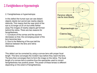 2. Farsightedness or hypermetropia
In this defect the human eye can see distant
objects clearly but cannot see nearby objects
distinctly. This means that the near point of the
eye is no longer at 25 cm but shifts farther
away.The images of nearby objects get formed
behind the retina. There are two reasons for
farsightedness.
1. Curvature of the cornea and the eye lens
decreases so that, the converging power of the
lens becomes less.
2. Due to the flattening of the eye ball the
distance between the lens and retina
decreases.
This defect can be corrected by using a convex lens with proper focal
length. This lens converges the incident rays before they reach the lens.
The lens then converges them to form the image on the retina. The focal
length of a convex lens is positive thus the spectacles used to correct
farsightedness has positive power. The power of these lenses is different
depending on the extent of farsightedness.
 