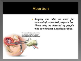 how do organisms reproduce