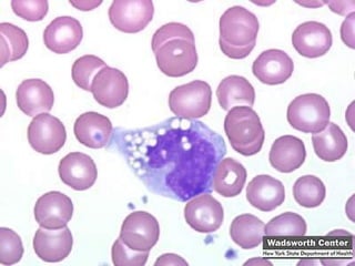 Cont.

Monocyte (left)

 