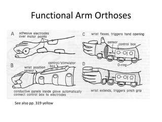 Functional Arm OrthosesSee also pp. 319 yellow
