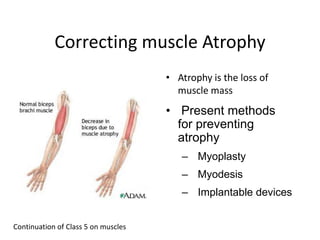 Correcting muscle AtrophyAtrophy is the loss of muscle mass Present methods for preventing atrophy  Myoplasty  Myodesis  Implantable devicesContinuation of Class 5 on muscles
