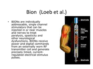 Bion  (Loeb et al.) BIONs are individually addressable, single channel stimulators that can be injected in or near muscles and nerves to treat paralysis, spasticity and other neurological dysfunctions. BIONs receive power and digital commands from an externally worn RF transmitter coil and generate precisely timed, current-regulated electrical stimulus pulses.