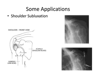 External computer controls BION™ activationBattery PoweredSwitch to turn power on or off