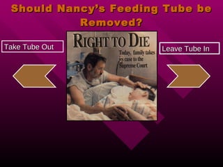 Should Nancy’s Feeding Tube be Removed? Take Tube Out Leave Tube In 