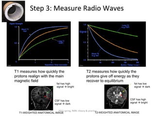 Step 3: Measure Radio Waves




T1 measures how quickly the                        T2 measures how quickly the
protons realign with the main                      protons give off energy as they
magnetic field                                     recover to equilibrium
                             fat has high                                             fat has low
                             signal  bright                                          signal  dark




                           CSF has low                                             CSF has high
                           signal  dark                                           signal  bright


                           2012 spring, fMRI: theory & practice
  T1-WEIGHTED ANATOMICAL IMAGE                                T2-WEIGHTED ANATOMICAL IMAGE
 