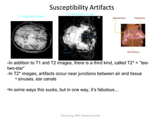 Susceptibility Artifacts
                                  T2*-weighted image
     T1-weighted image




                                                  sinuses



                               ear
                               canals



-In addition to T1 and T2 images, there is a third kind, called T2* = “tee-
two-star”
-In T2* images, artifacts occur near junctions between air and tissue
     • sinuses, ear canals

•In some ways this sucks, but in one way, it’s fabulous…




                             2012 spring, fMRI: theory & practice
 