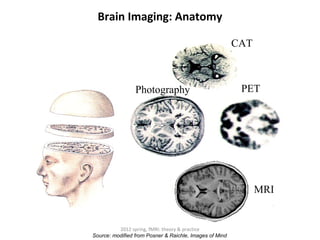 Brain Imaging: Anatomy

                                                         CAT



                 Photography                              PET




                                                               MRI


          2012 spring, fMRI: theory & practice
Source: modified from Posner & Raichle, Images of Mind
 