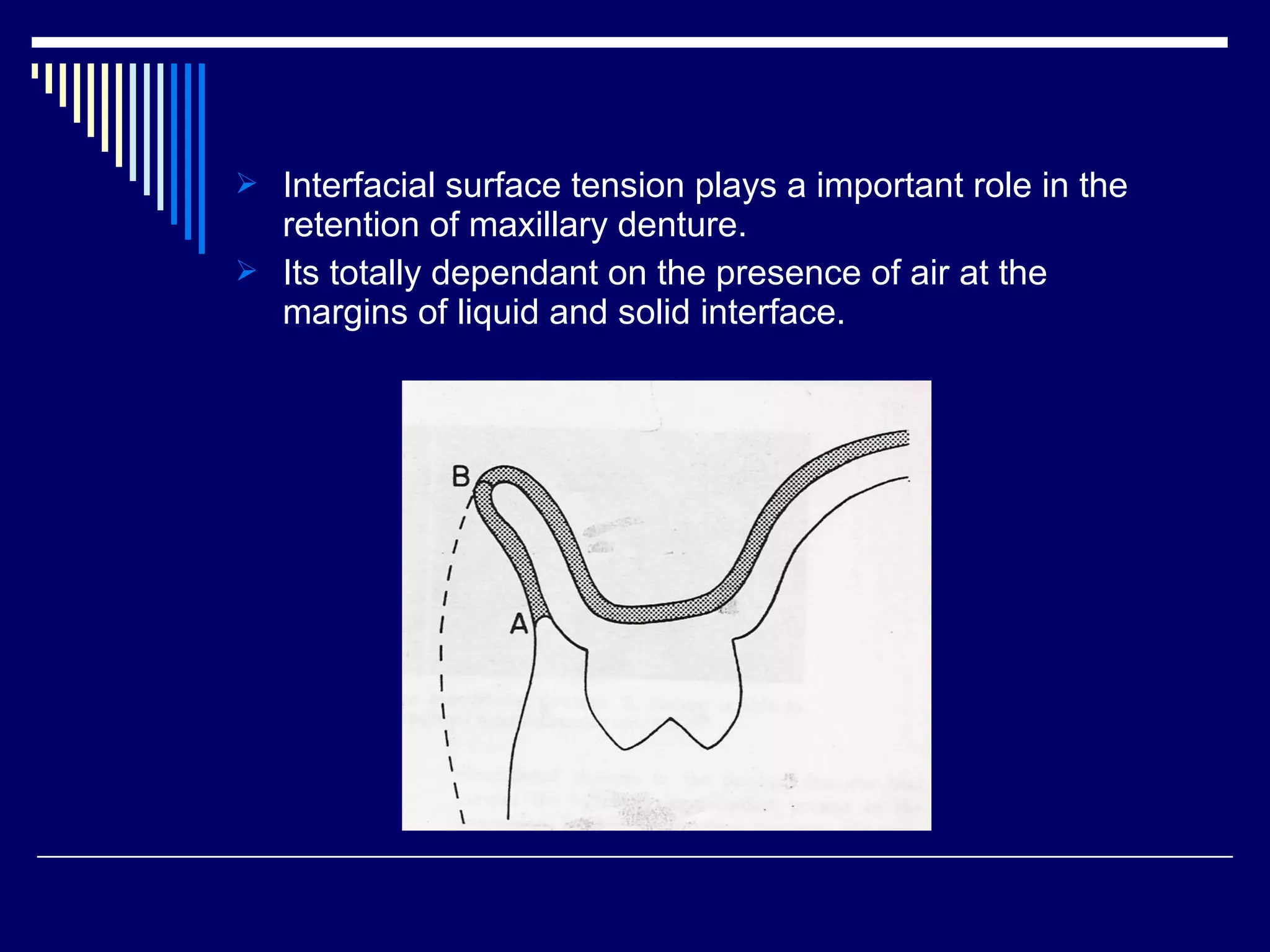  Interfacial surface tension plays a important role in the
retention of maxillary denture.
 Its totally dependant on the presence of air at the
margins of liquid and solid interface.
 