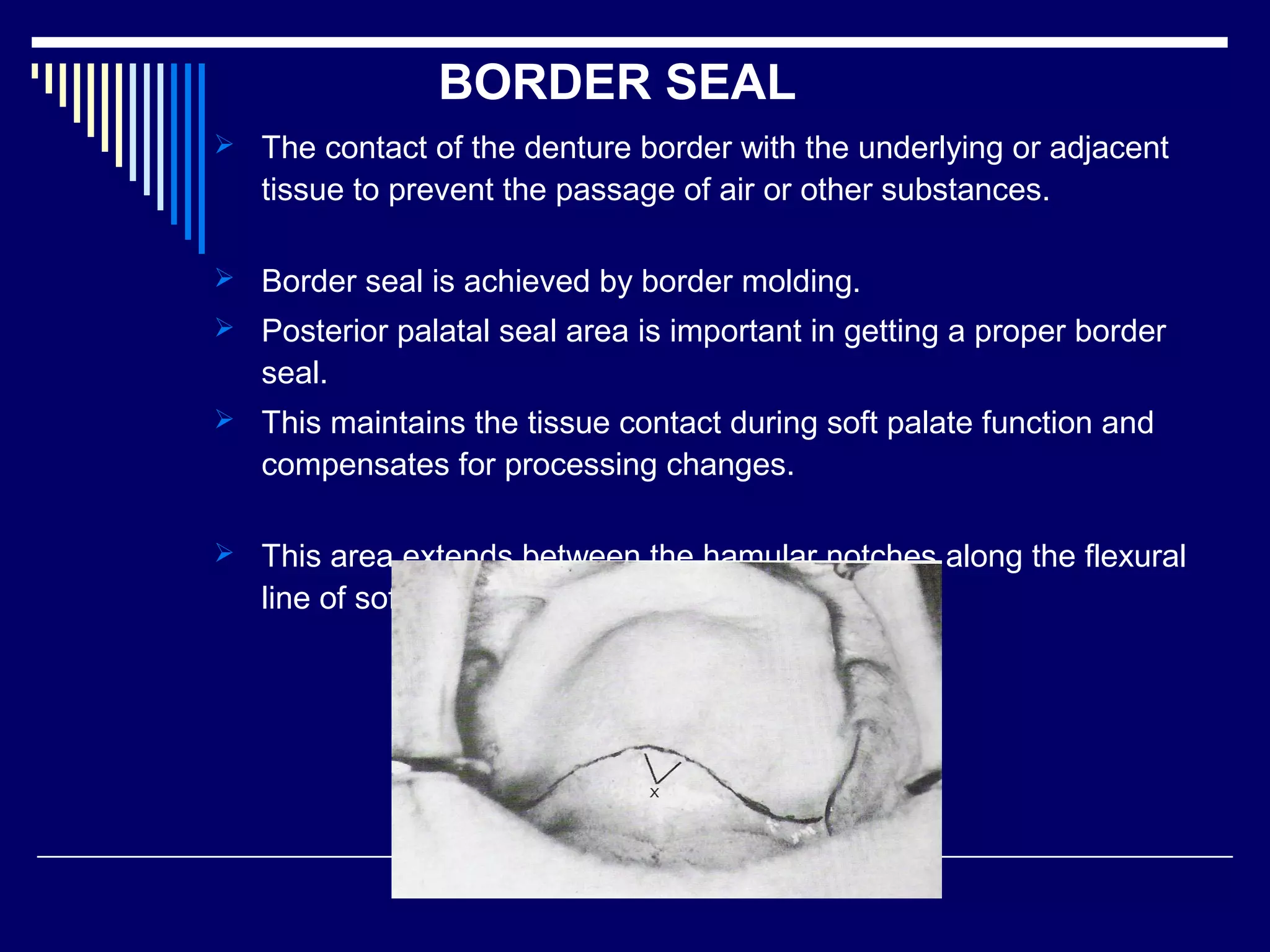 BORDER SEAL
 The contact of the denture border with the underlying or adjacent
tissue to prevent the passage of air or other substances.
 Border seal is achieved by border molding.
 Posterior palatal seal area is important in getting a proper border
seal.
 This maintains the tissue contact during soft palate function and
compensates for processing changes.
 This area extends between the hamular notches along the flexural
line of soft palate
 