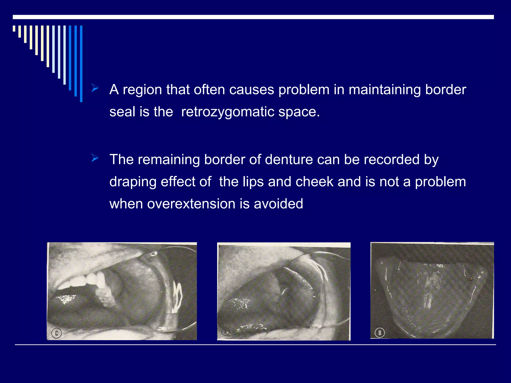  A region that often causes problem in maintaining border
seal is the retrozygomatic space.
 The remaining border of denture can be recorded by
draping effect of the lips and cheek and is not a problem
when overextension is avoided
 