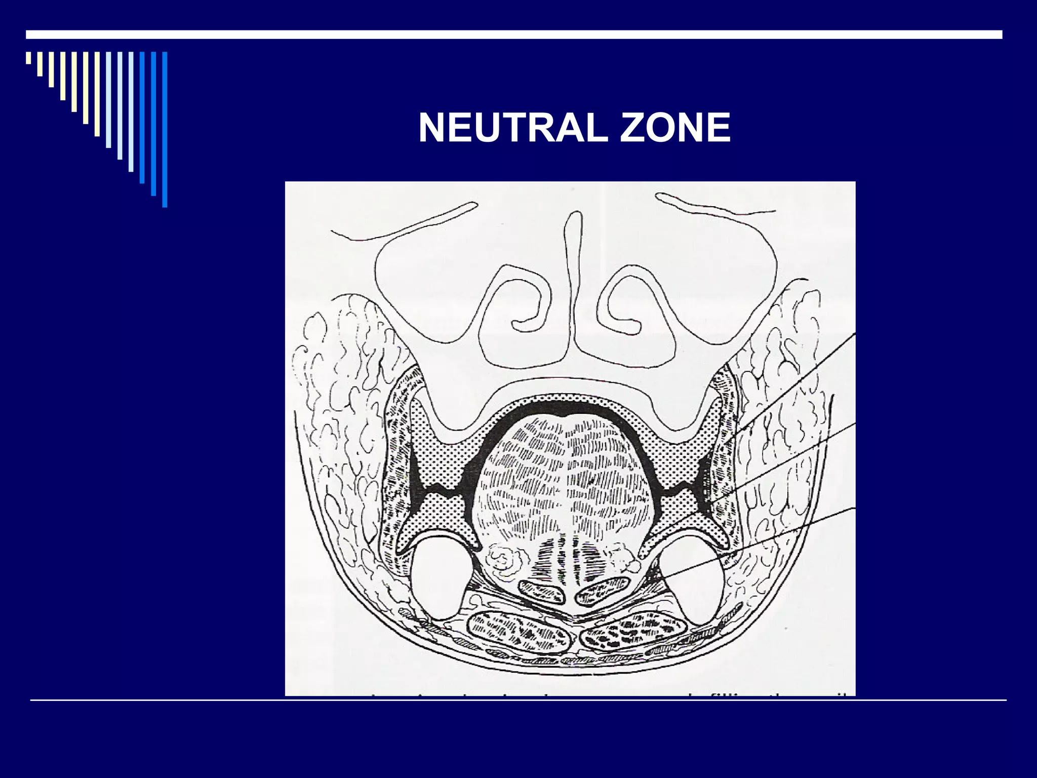 NEUTRAL ZONE
 
